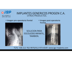 Craneoplastia personalizada, PEEK, en titanio y malla, - Imagen 4/6